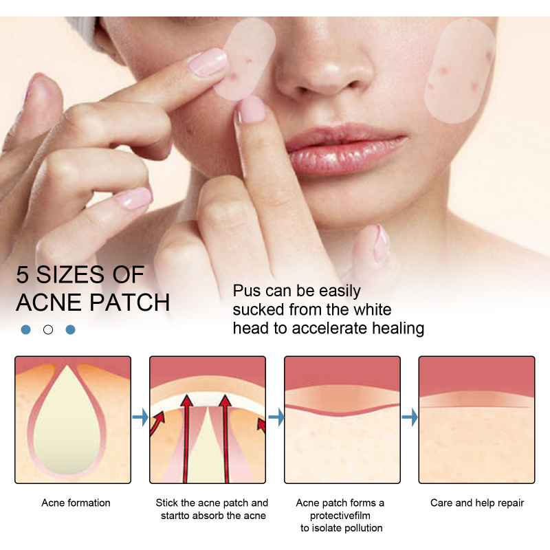 EELHOE Acne Patch, Hydrocolloidal Invisible Acne-Clearing Anti Acne And Pimple Waterproof Patch - Image 4