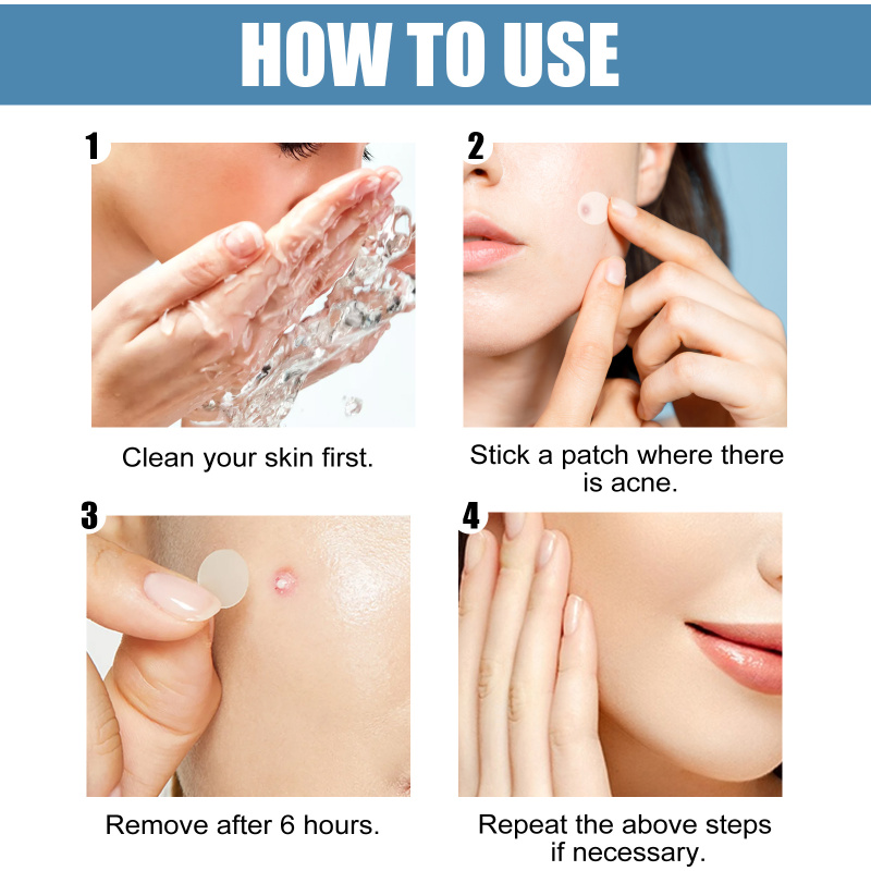 EELHOE Acne Patch, Hydrocolloidal Invisible Acne-Clearing Anti Acne And Pimple Waterproof Patch - Image 6