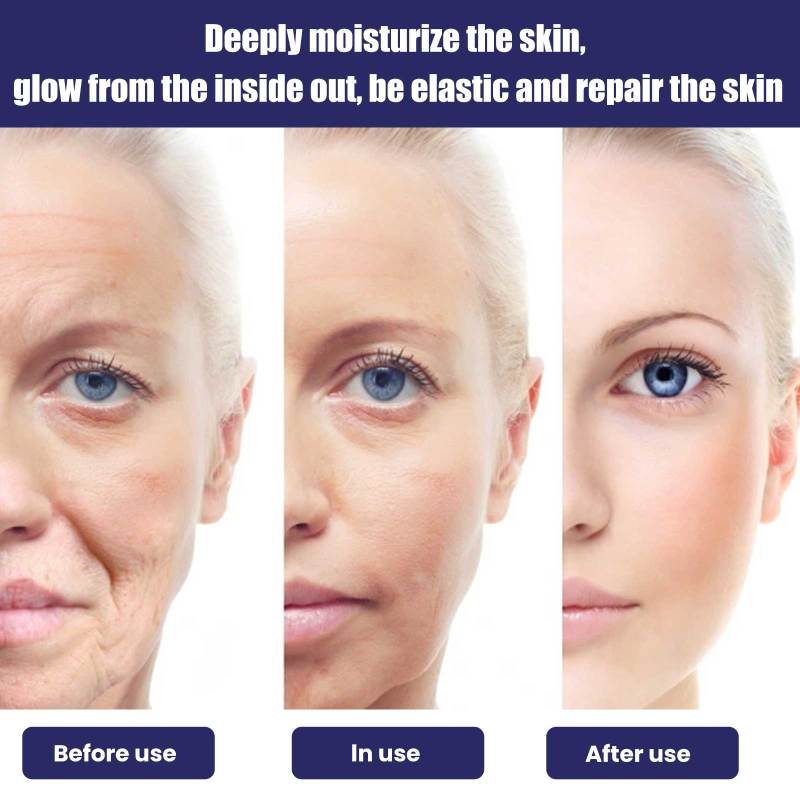 OUHOE Moisturizing Cream, Reduce Dark Spots And Fine Lines, Moisturize Firm Skin Care Cream - Image 4