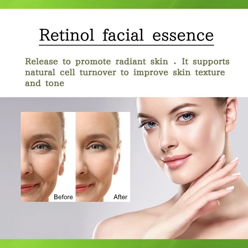 OUHOE Retinol Serum, Face Anti-Wrinkle Firming Brightening Soft And Smooth Skin Serum - Image 4