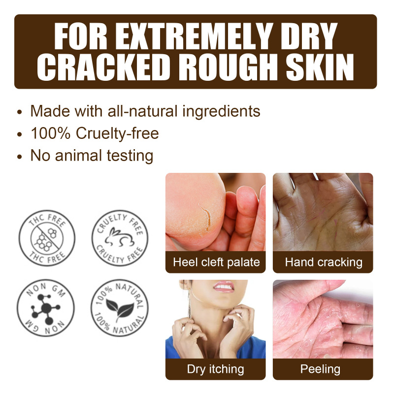 South Moon Cracked Heel Care Cream, Repair Foot Anti-Cracking, Peeling And Chapping Moisturizing Foot Cream - Image 3