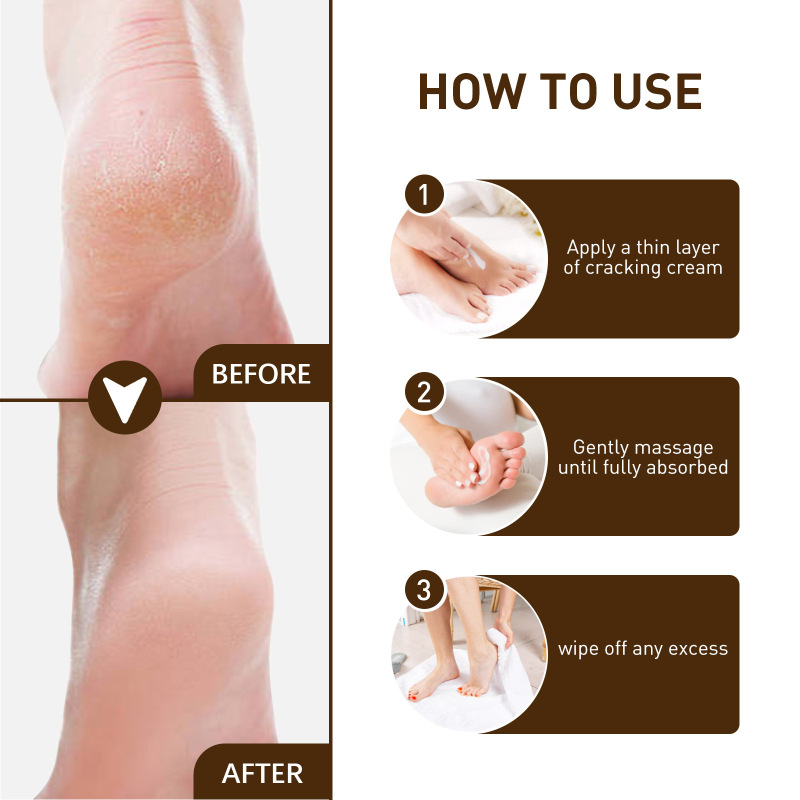 South Moon Cracked Heel Care Cream, Repair Foot Anti-Cracking, Peeling And Chapping Moisturizing Foot Cream - Image 6
