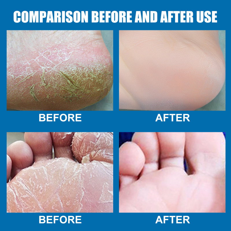 EELHOE Antifreeze Cream - Image 3