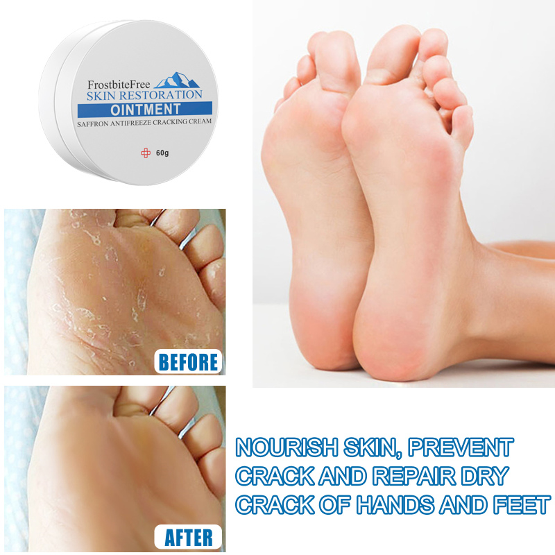 EELHOE Antifreeze Cream - Image 4